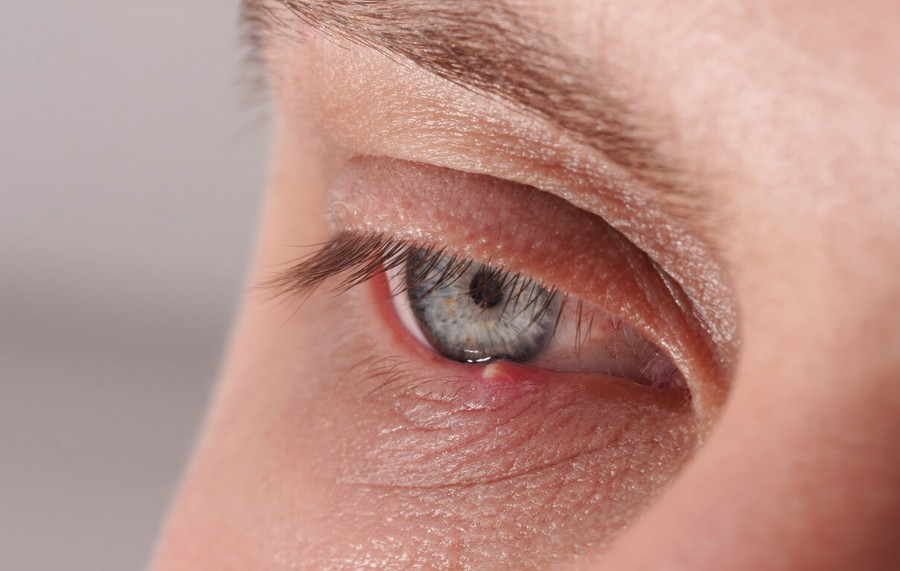 Jęczmień - Gradówka